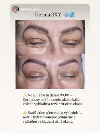 ✨ Nechajte hovoriť výsledky – A transformujte svoj salón s DermaOXY! ✨ Kozmetičky, vidíte tú zmenu? 🤩 Takýto „WOW efekt“...